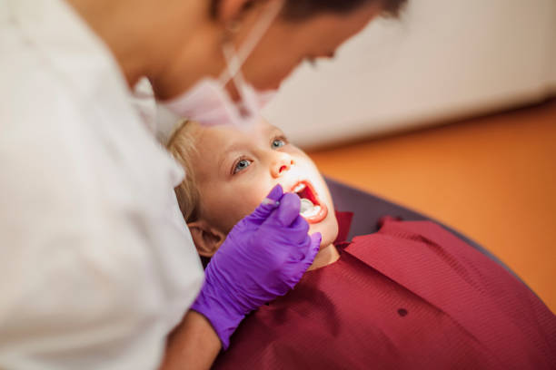Best Knocked-Out Tooth (Avulsed Tooth) Treatment in Bradenton, FL